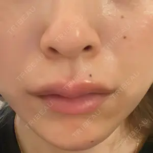 HAAB×DREAM BEAUTY CLINIC 東京本院口コミ