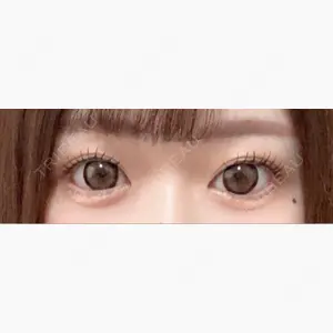 エターナル美容クリニック口コミ