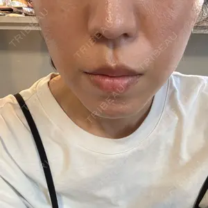 ルラ美容クリニック 大阪本院口コミ