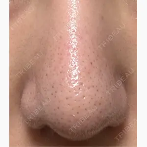 美容皮膚科エルムクリニック 福岡院口コミ