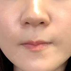 おおたかの森ビューティークリニック口コミ