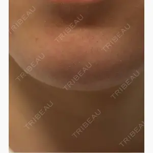 ルラ美容クリニック 横浜院口コミ