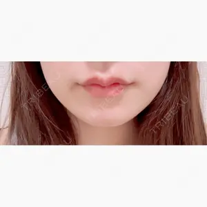 ルラ美容クリニック 大阪本院口コミ