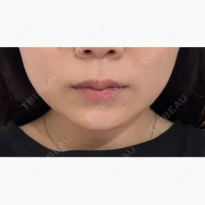 Wi Clinic （ウィ クリニック）心斎橋院口コミ