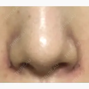 ヴェリテクリニック 銀座院口コミ