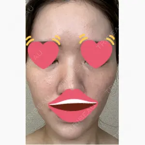 メディカルエピレーションクリニック 心斎橋院口コミ