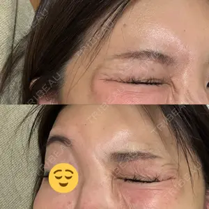 TCB東京中央美容外科 町田院口コミ