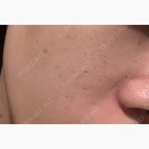 レナータクリニック 新宿院口コミ