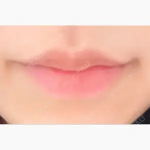 ルラ美容クリニック 京都院口コミ