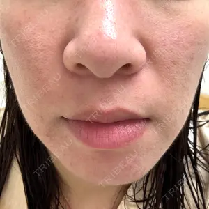 南青山コスメクリニック口コミ