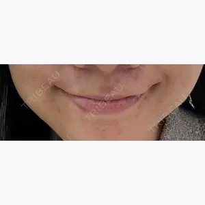 ルラ美容クリニック 名古屋本院口コミ
