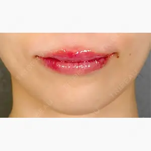 アリエル美容クリニック 大宮院口コミ