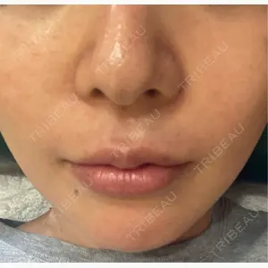 TCB東京中央美容外科 福岡博多院口コミ