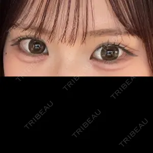 Brandnew Beauty Clinic口コミ