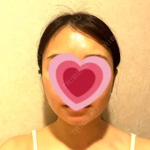 脂肪吸引ラボトウキョウ口コミ