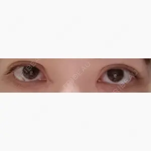 R Beauty CLINIC 大阪院口コミ