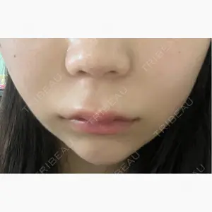 東京美専クリニック口コミ