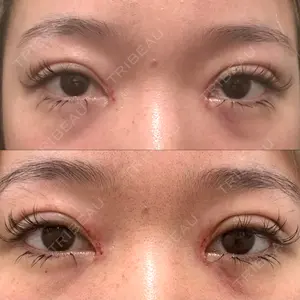 東京イセアクリニック口コミ