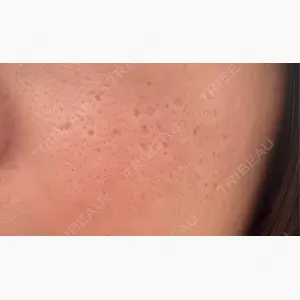 Re:anne clinic 銀座 【リアンクリニック銀座】口コミ