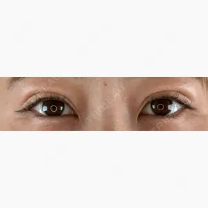 Brandnew Beauty Clinic口コミ