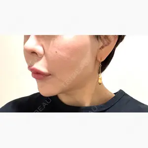 GLAMRULE CLINIC (グラムルール クリニック) 銀座院口コミ