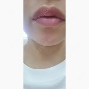 ルラ美容クリニック 静岡院口コミ