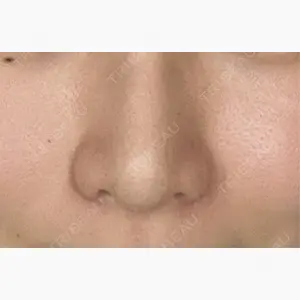 グローバルビューティークリニック 大阪院口コミ