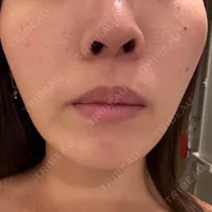 DAILY SKIN CLINIC 福岡院口コミ