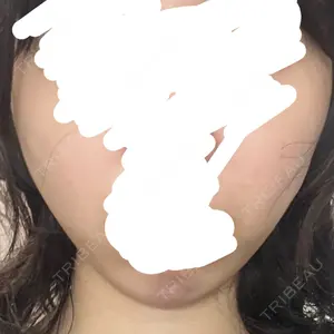 AB美容クリニック 新宿院口コミ