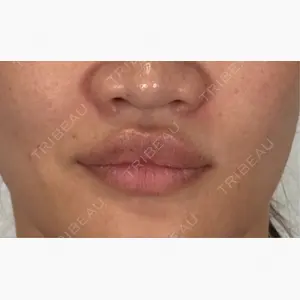 アリエル美容クリニック 横浜院口コミ