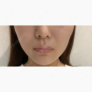 藤・ナチュレ美容クリニック 銀座院口コミ