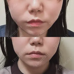 ルラ美容クリニック 横浜院口コミ