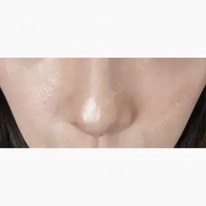 藤・ナチュレ美容クリニック 銀座院口コミ