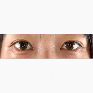 Brandnew Beauty Clinic口コミ