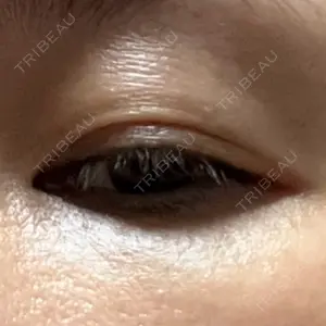 ルーチェクリニック 銀座院口コミ