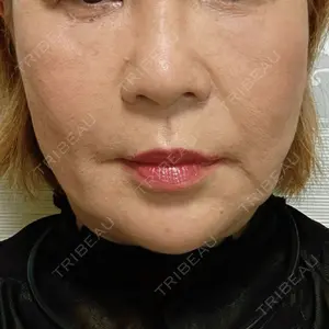 藤・ナチュレ美容クリニック 銀座院口コミ