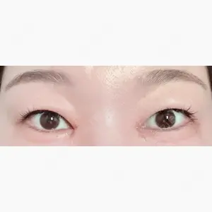 東京シンデレラ美容外科 池袋院口コミ