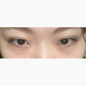 吉祥寺アイビークリニック口コミ