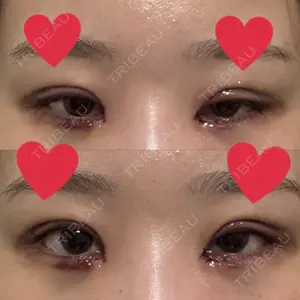 聖心美容クリニック 銀座院口コミ