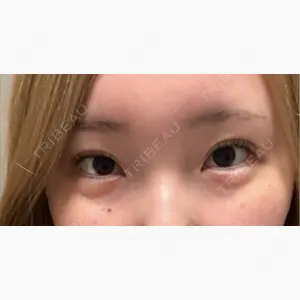 AYANAフィラーズクリニック 渋谷院口コミ
