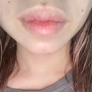 アリエル美容クリニック 横浜院口コミ