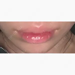 B-LINE CLINIC 池袋院口コミ