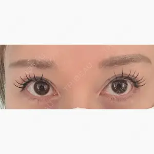 プラザ美容外科口コミ