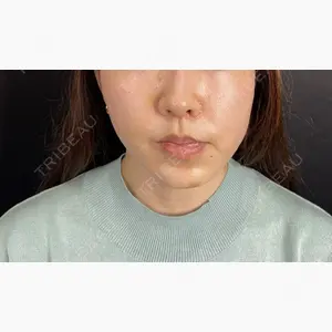 藤・ナチュレ美容クリニック 銀座院口コミ