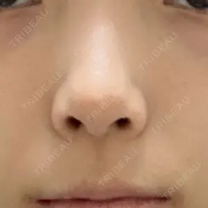 聖心美容クリニック 銀座院口コミ