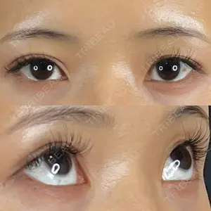 藤・ナチュレ美容クリニック 銀座院口コミ