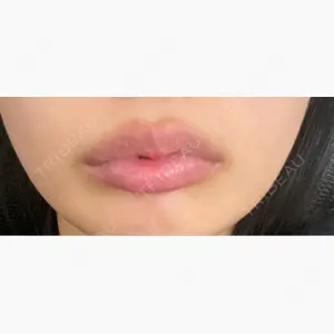 Wi Clinic （ウィ クリニック）心斎橋院口コミ