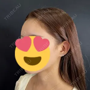 藤・ナチュレ美容クリニック 銀座院口コミ