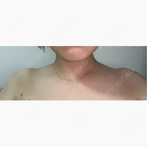 ライズワン美容皮膚科クリニック口コミ