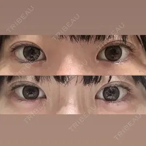 銀座美容外科クリニック 銀座院口コミ